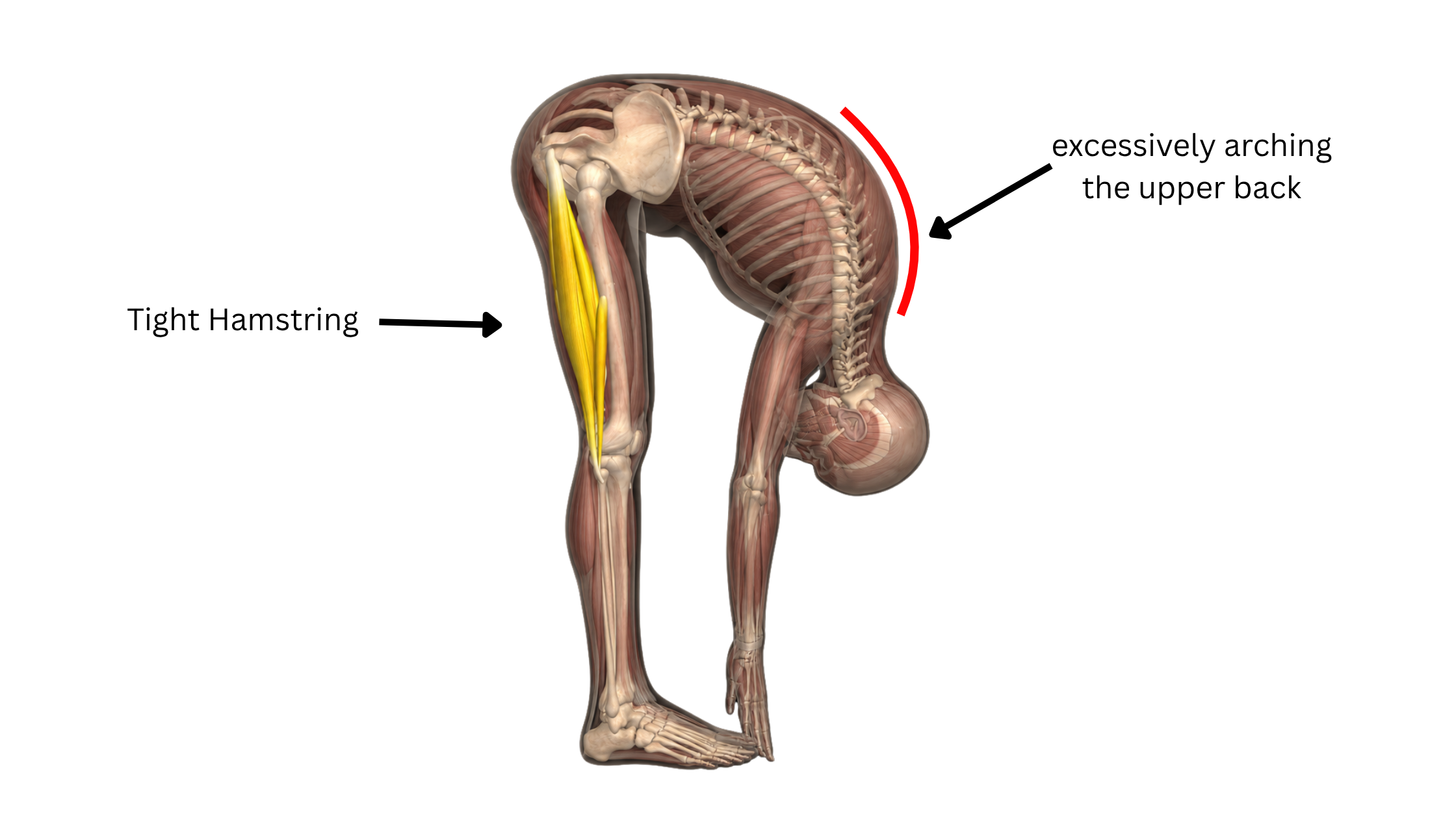 Problem with Uttanasan (Standing forward fold bend)