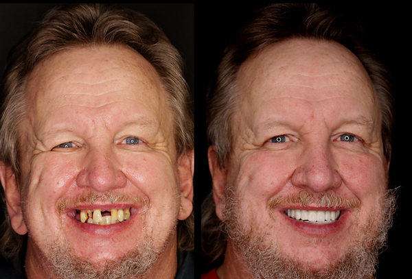 Transformation 1