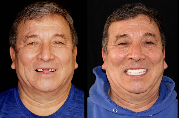 Transformation 7