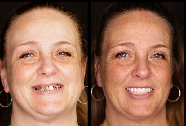 Transformation 6