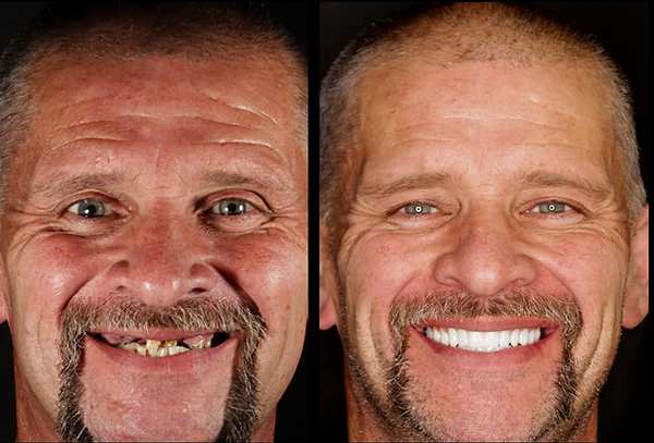 Transformation 9