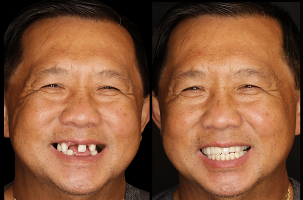 Transformation 8