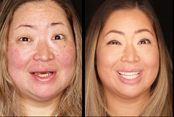 Transformation 4