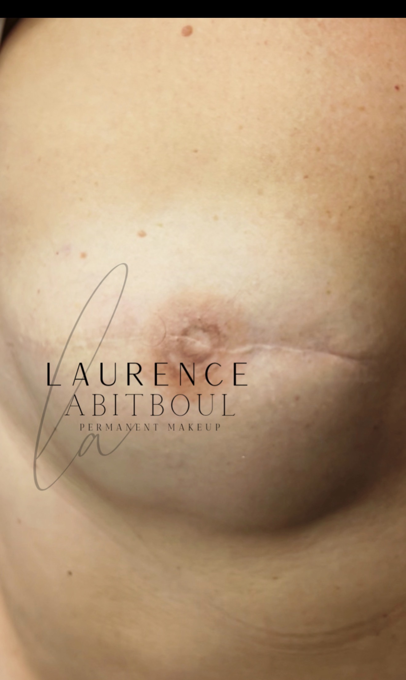 Pigmentation lèvres voile de couleur · Laurence Abitboul Chantilly