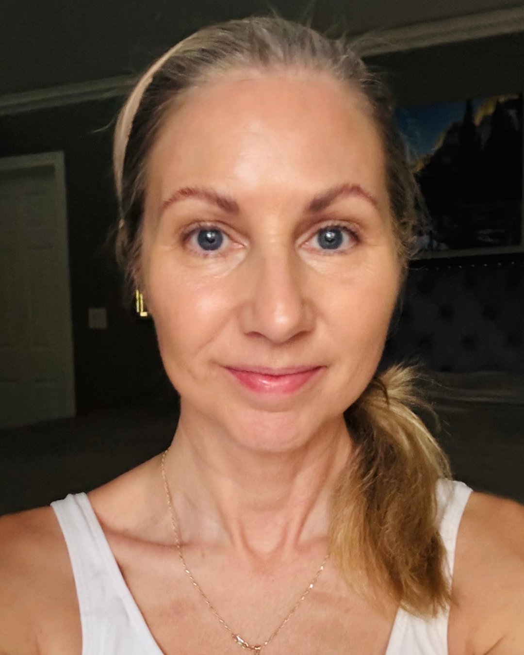 Client 1 after Beauty Longevity treatment