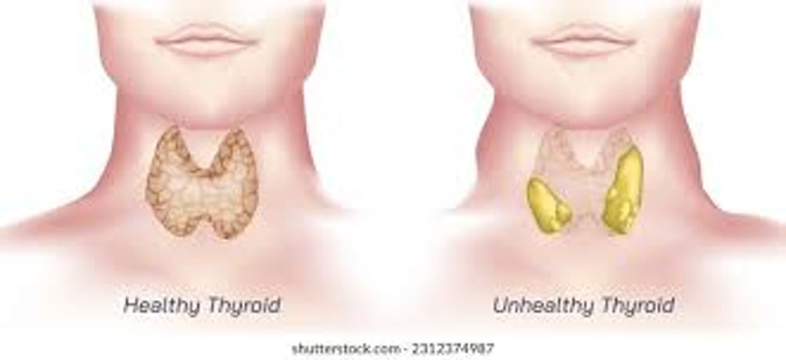 Thyroid Optimization