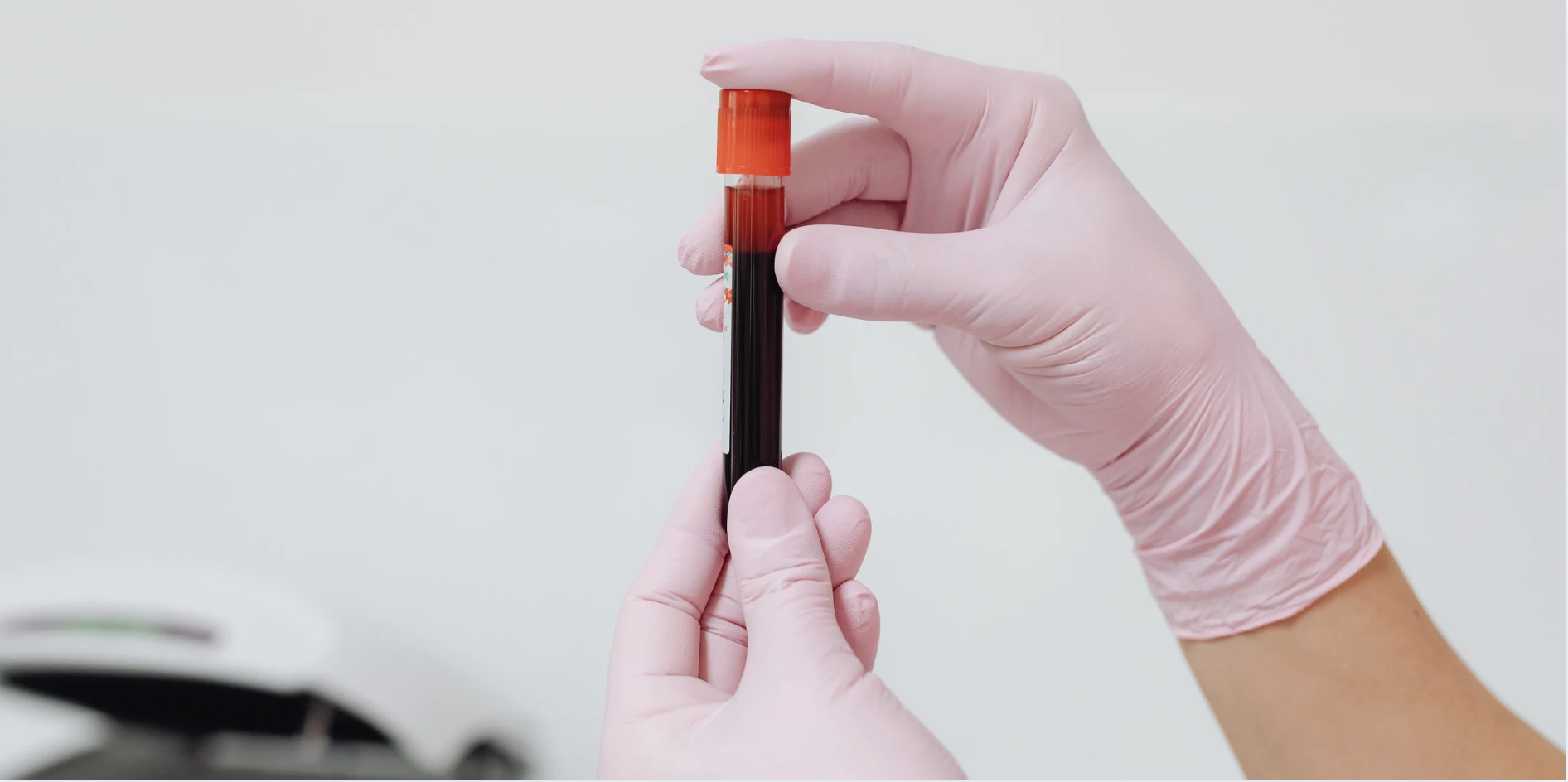 How "Normal" is Not "Optimal" on Your Blood Test