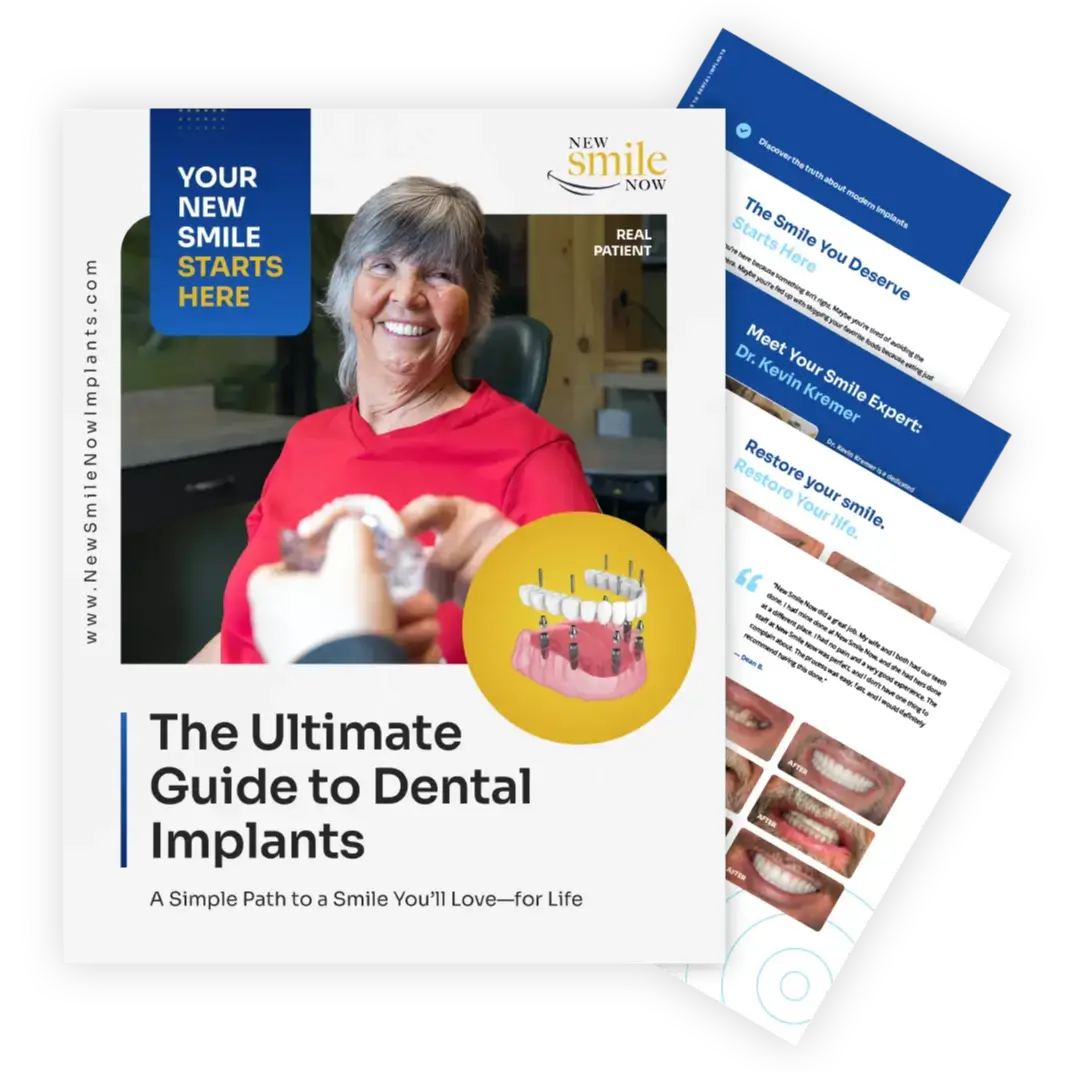 The Ultimate Guide to Dental Implants