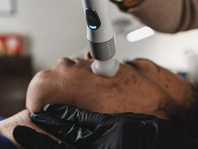 Jet Plasma treatment on a client's face