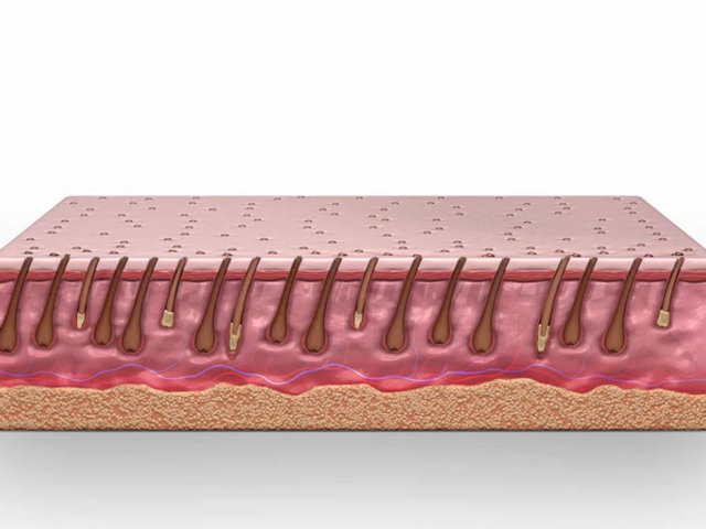 Illustration of hair follicles beneath the skin