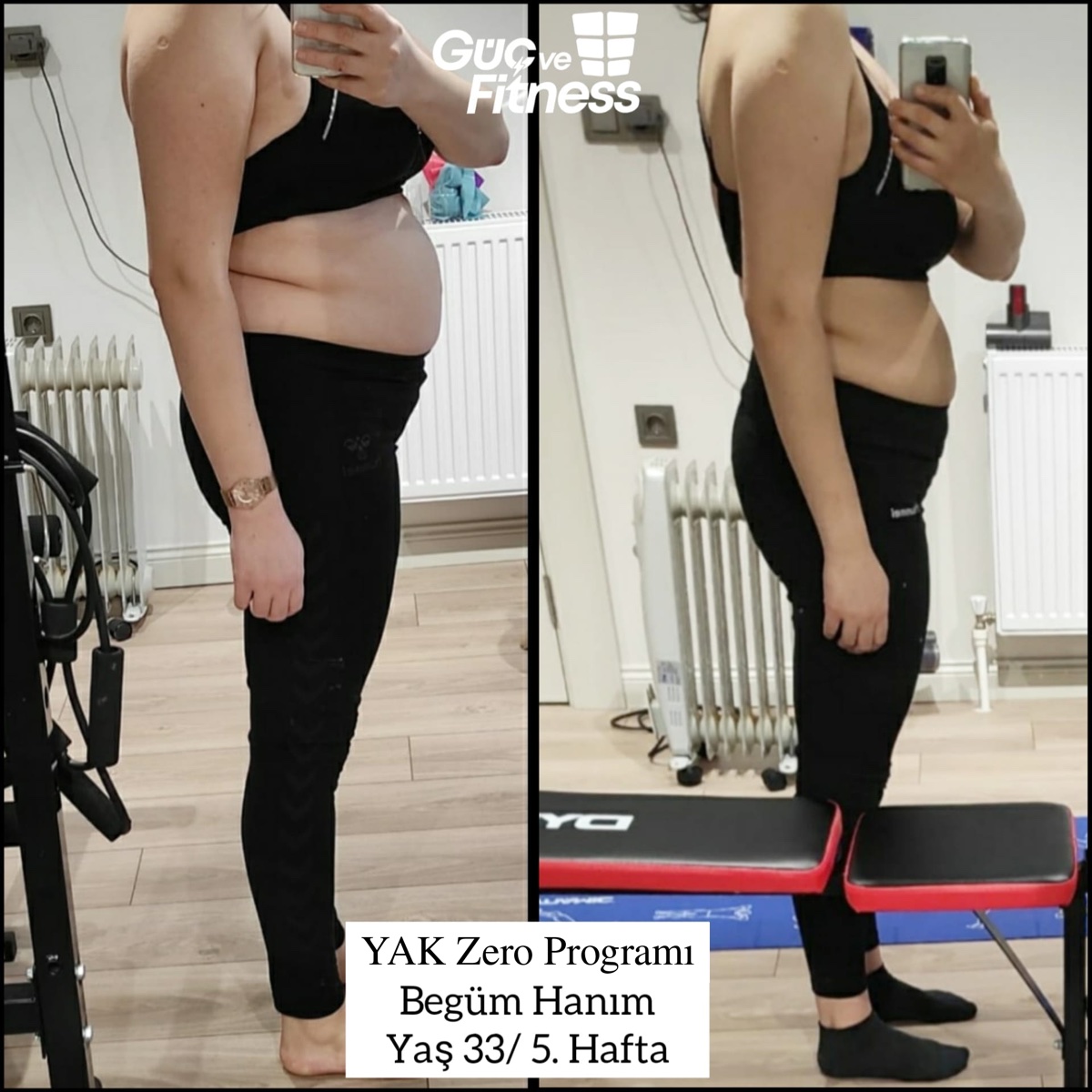 Begüm Hanım — YAK Zero programı önce/sonra