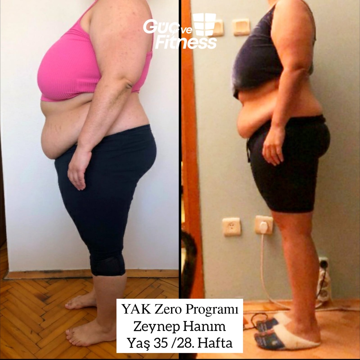 Zeynep Hanım — YAK Zero programı önce/sonra