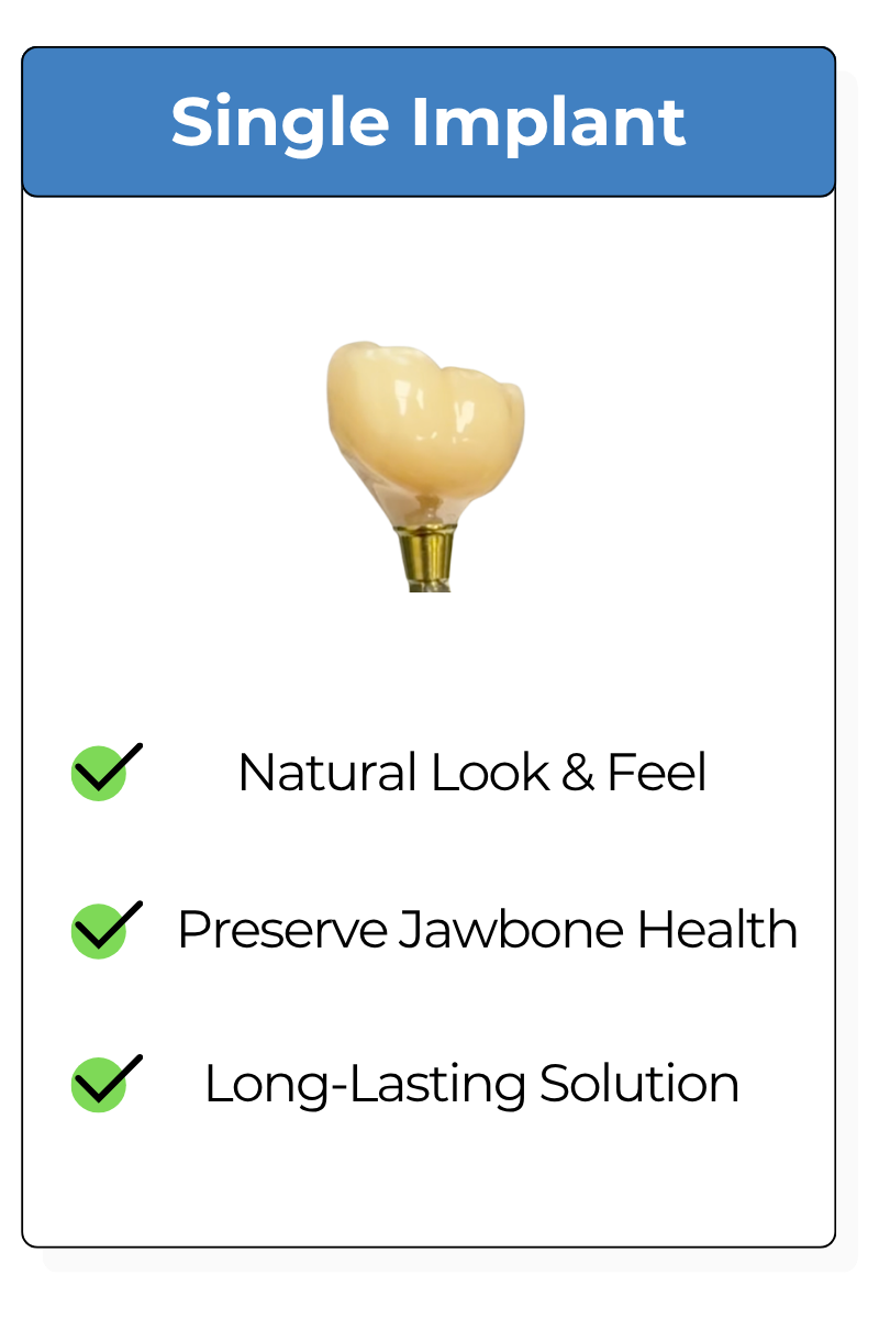 Single Dental Implant