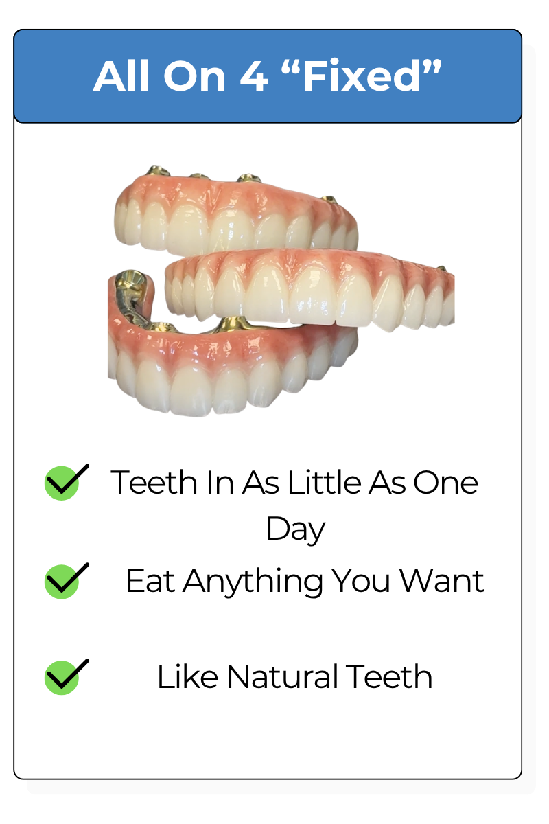All on Four Dental Implants