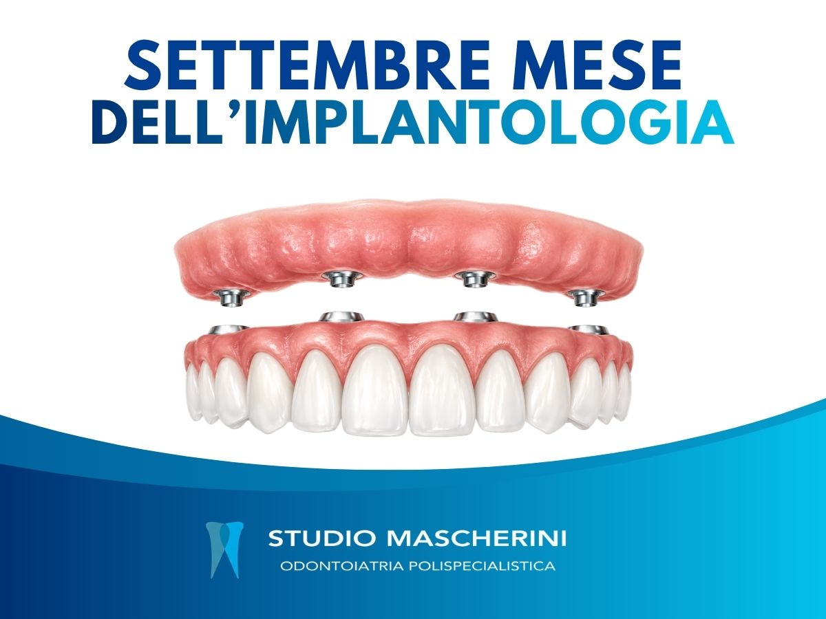 Paziente soddisfatto insieme al dottor Cosimo Mascherini dopo la riabilitazione implantare
