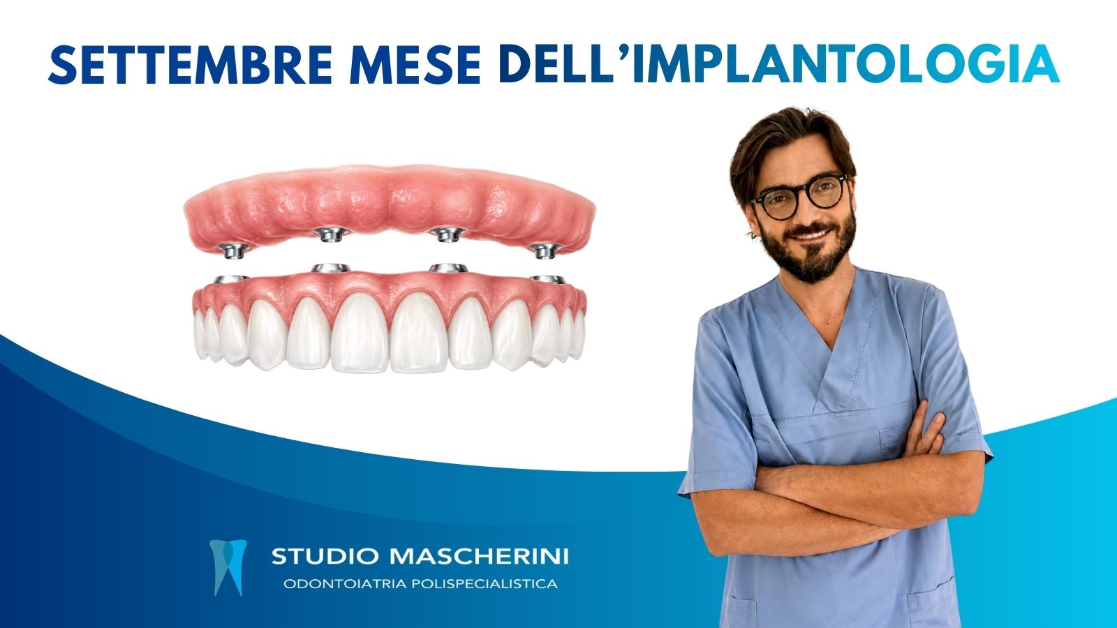 Settembre Mese dell'Implantologia - Studio Dentistico Mascherini con protesi su impianti dentali