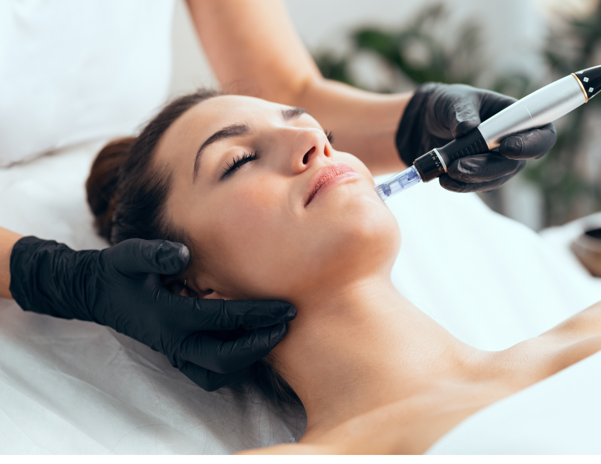 Professional SkinPen microneedling treatment