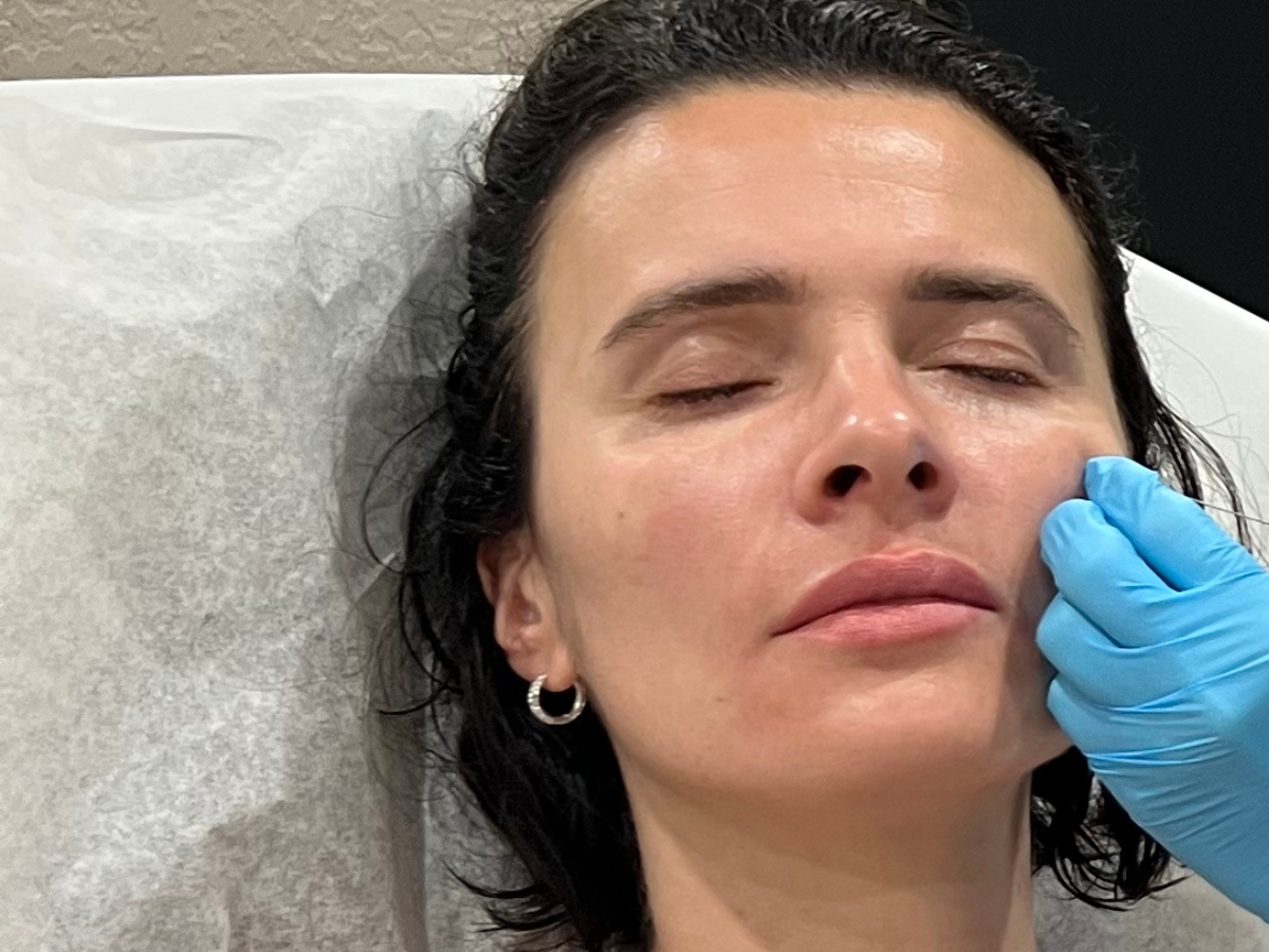 Dermal fillers and facial balancing treatment at Dash Medical Spa in Delray Beach