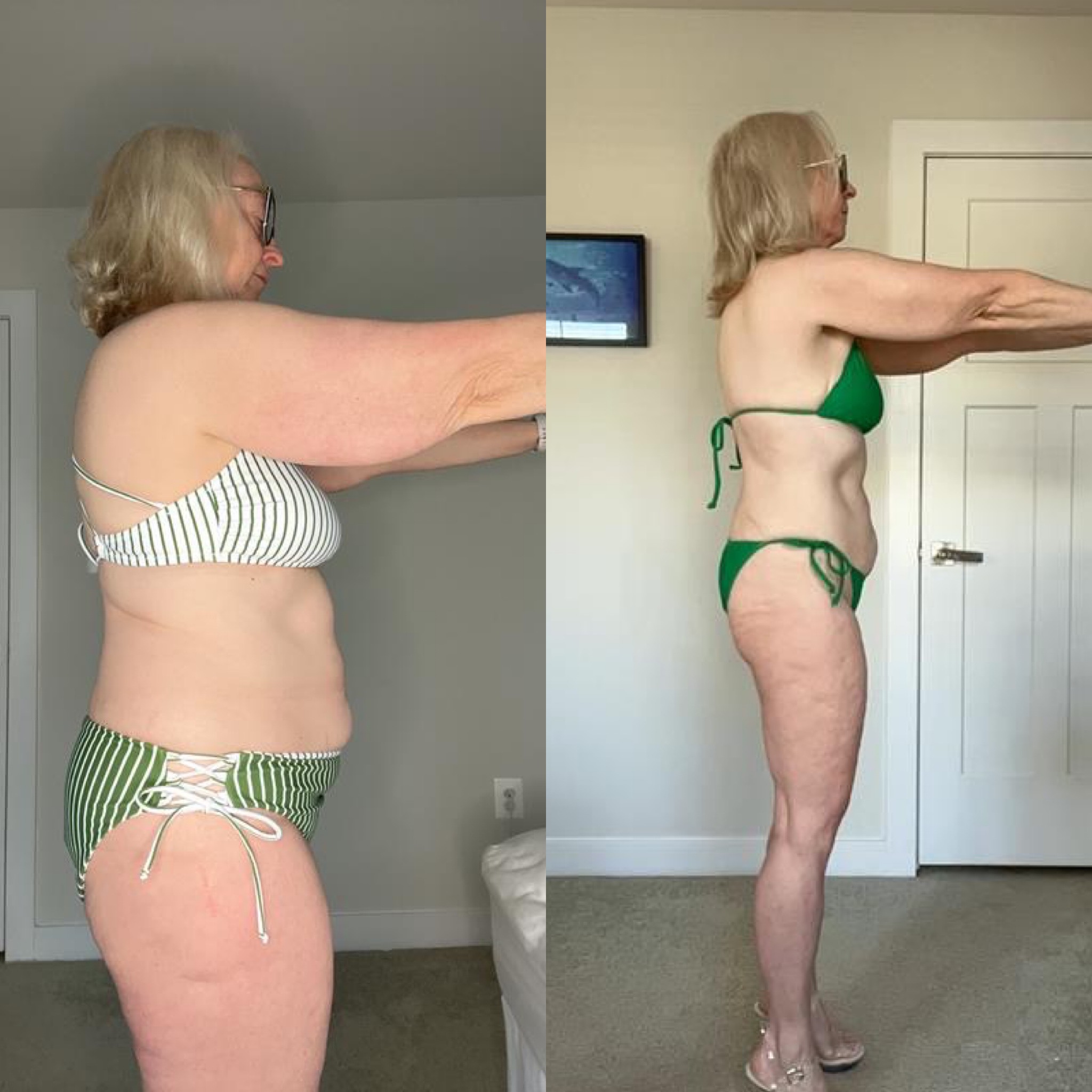 Sara B. before-and-after, side view