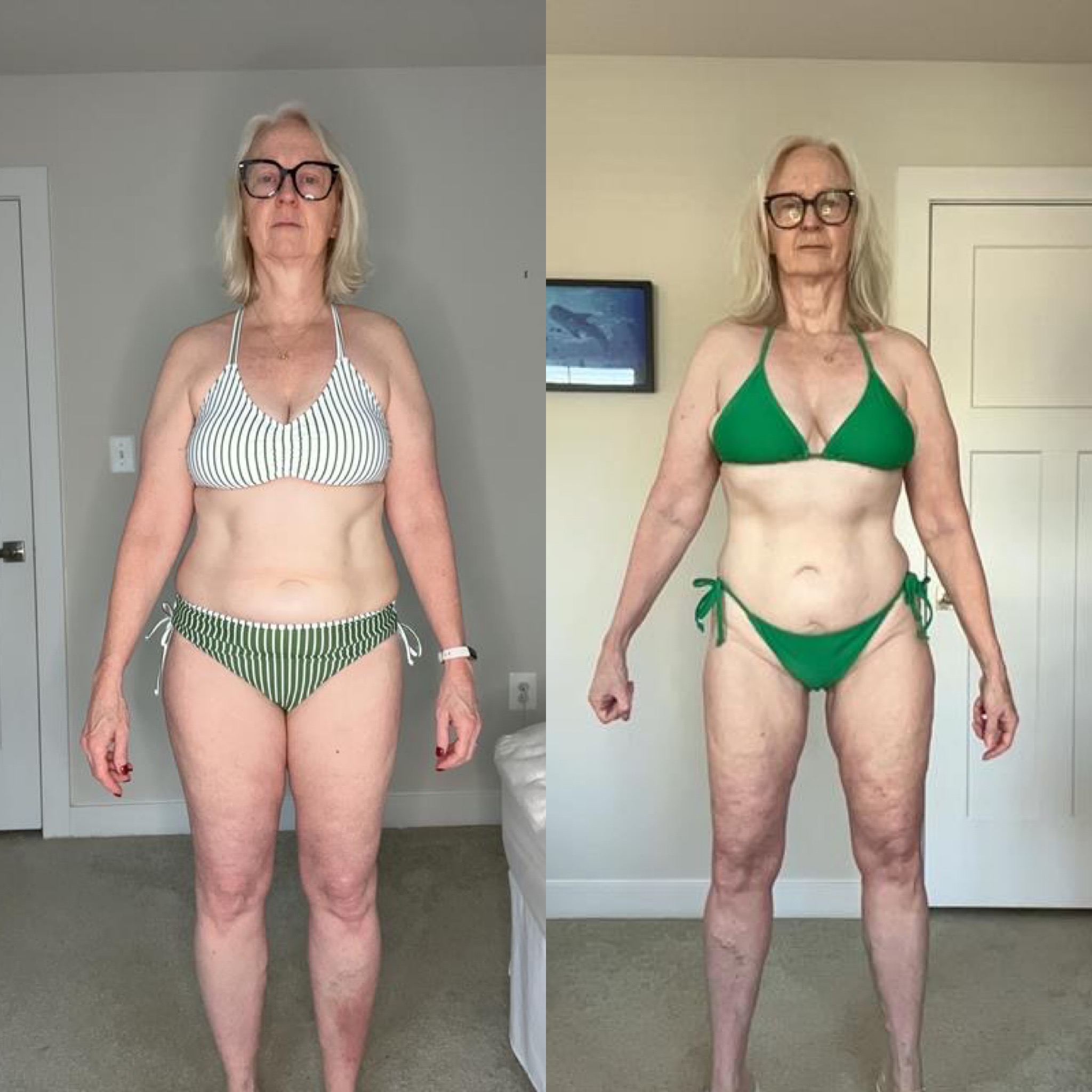 Sara B. before-and-after, front view
