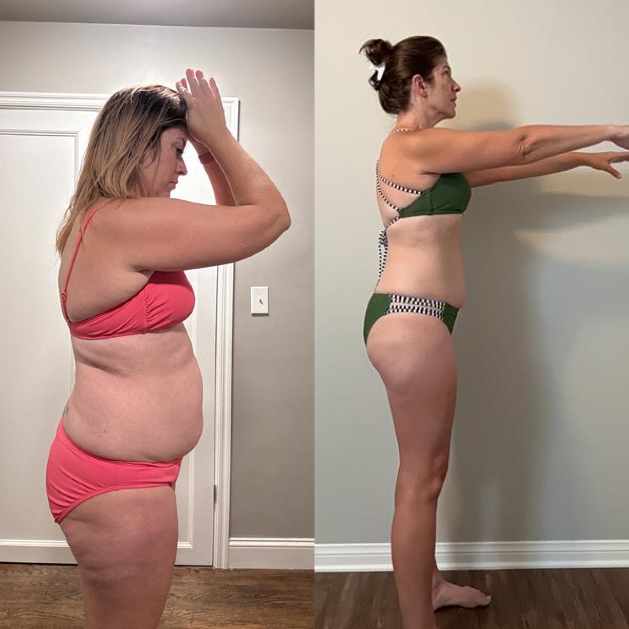Abby S. before-and-after, side view