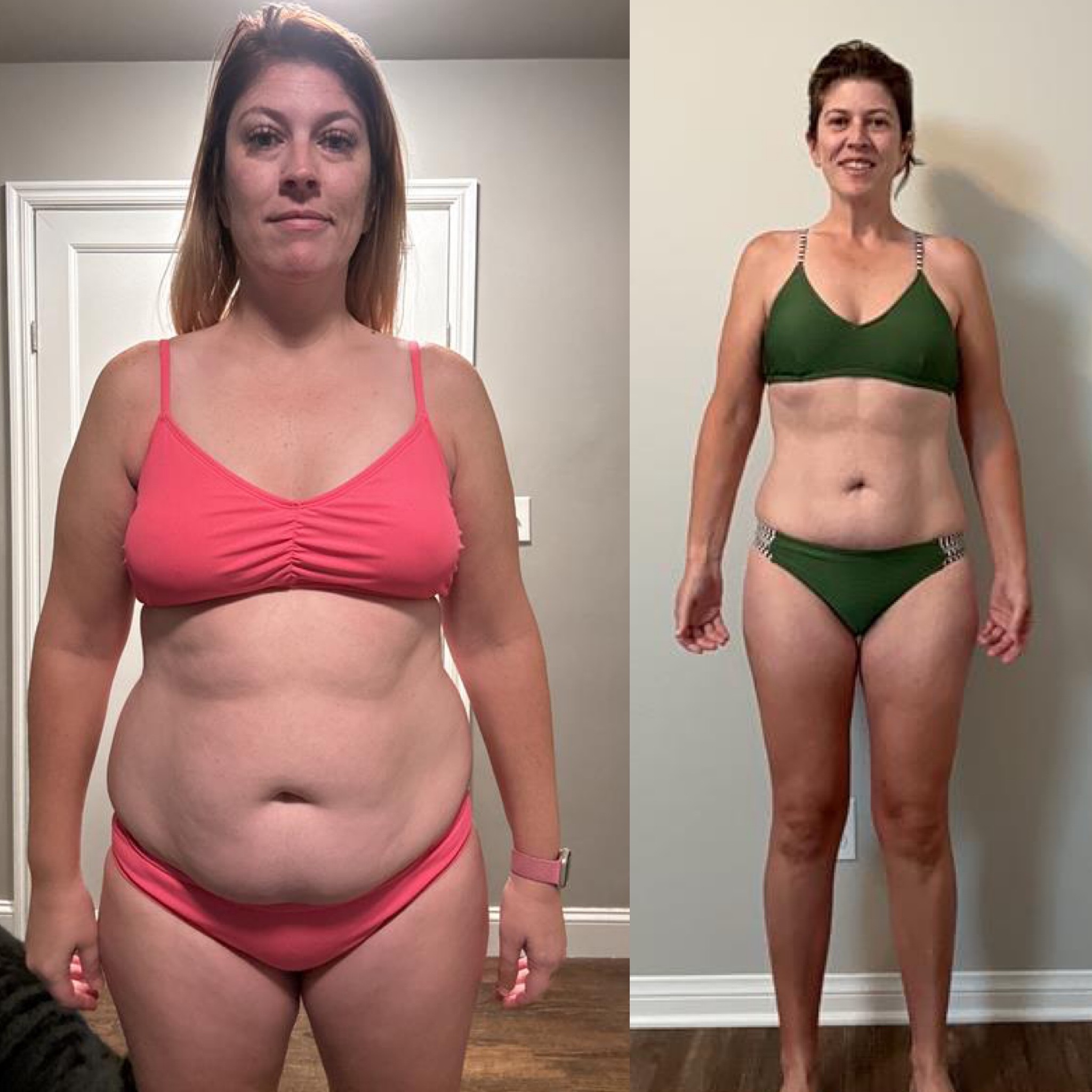 Abby S. before-and-after, front view