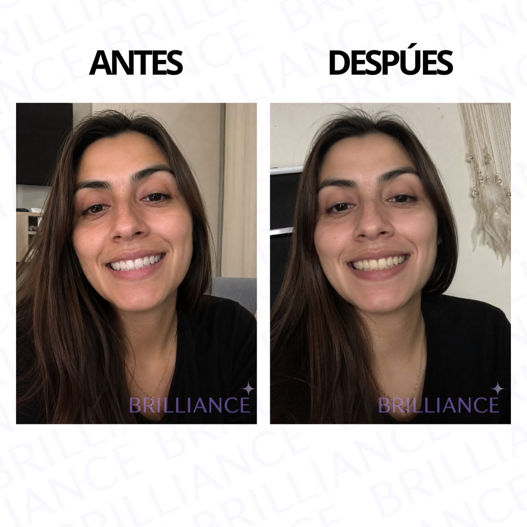 Antes y después usando Brilliance