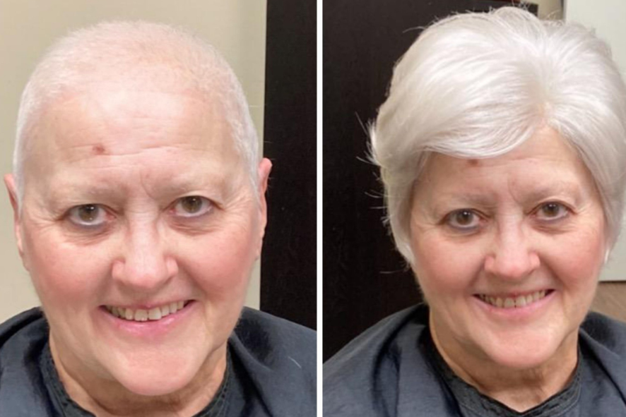 Restore Non Surgical Hair Replacement Center - Business Photo