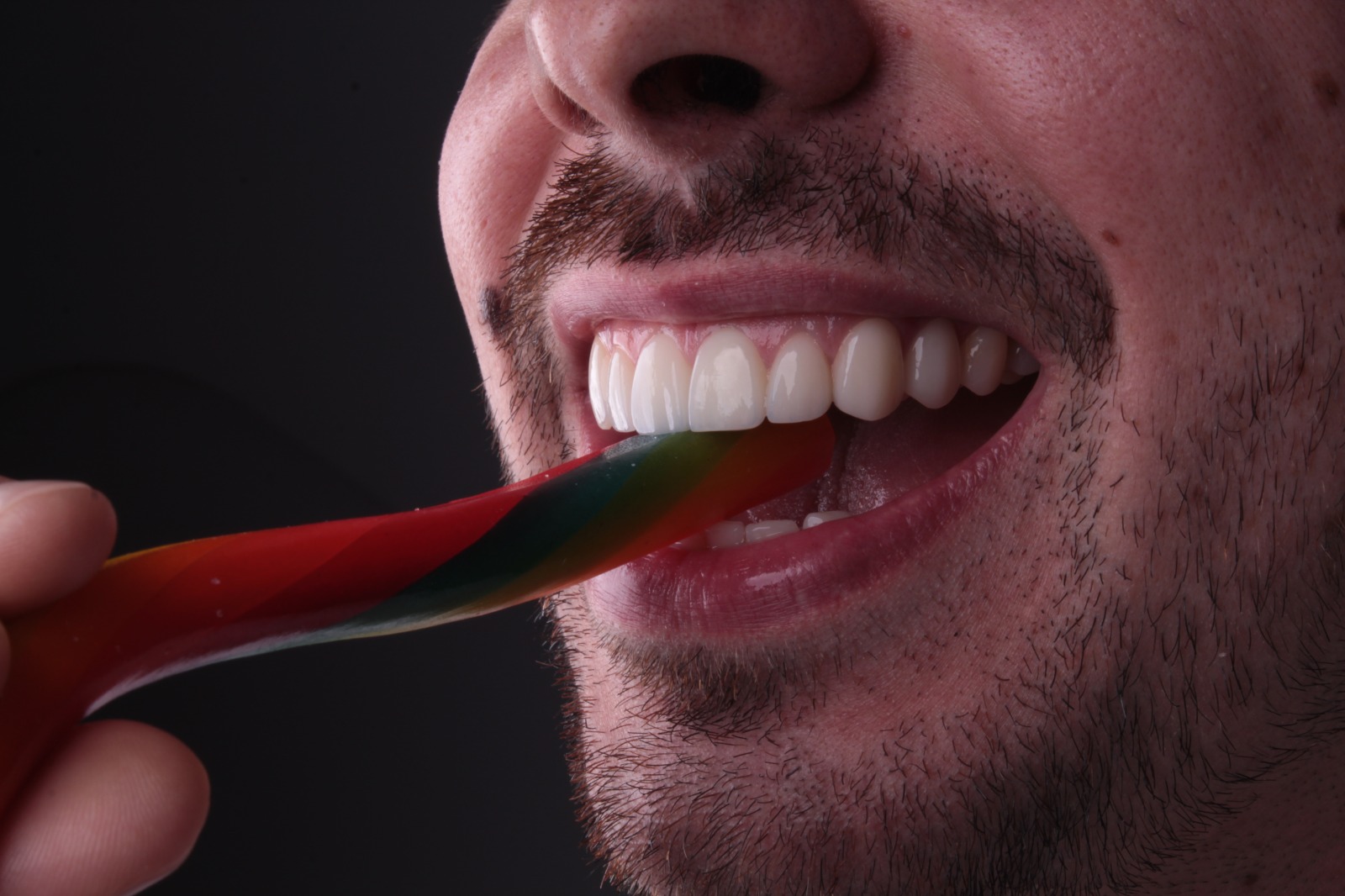 Sonrisa final tras tratamiento con carillas cerámicas de estética natural de alto nivel