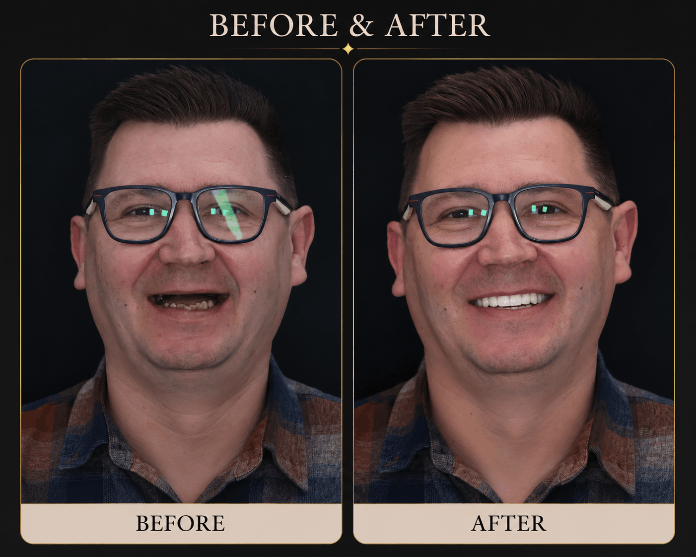 Dental implant transformation - Dental Atelier patient 1