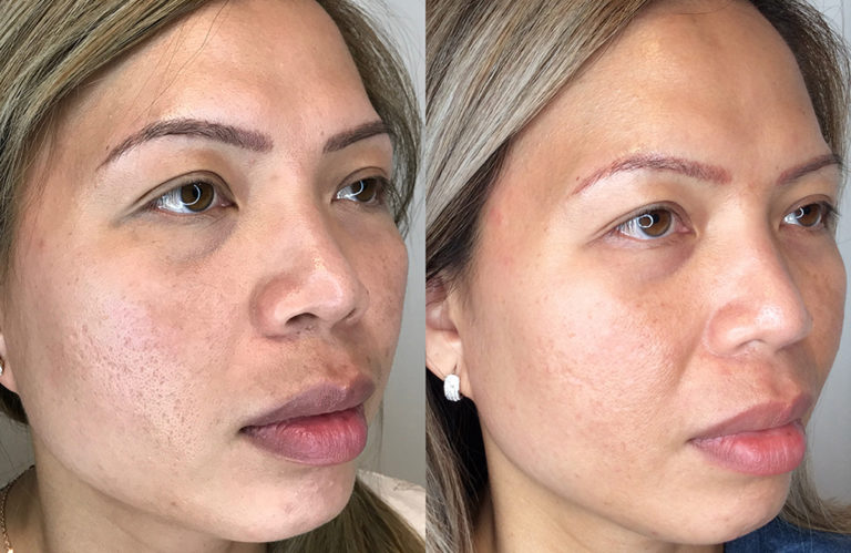 Client result example