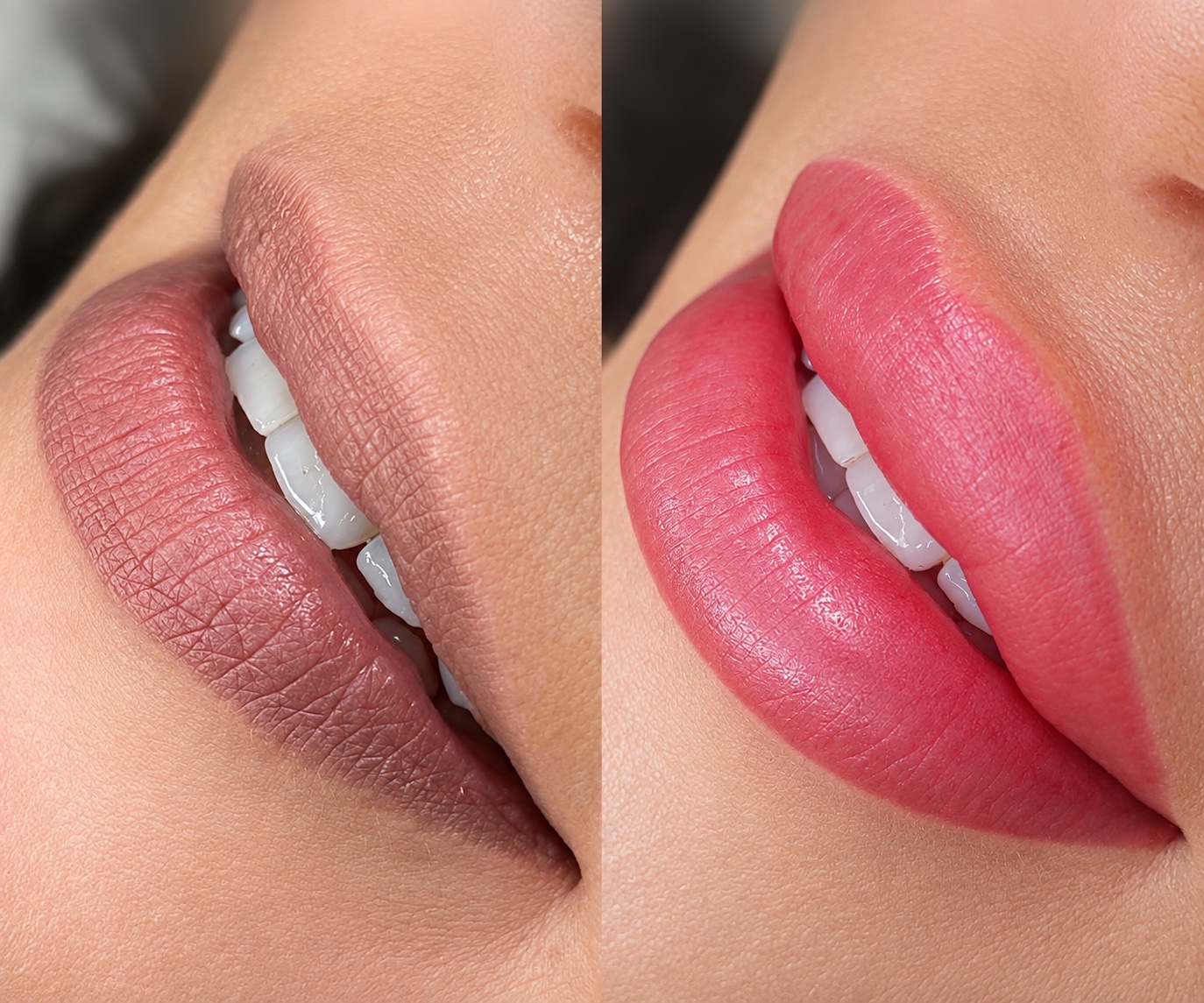 Labios antes de la neutralización