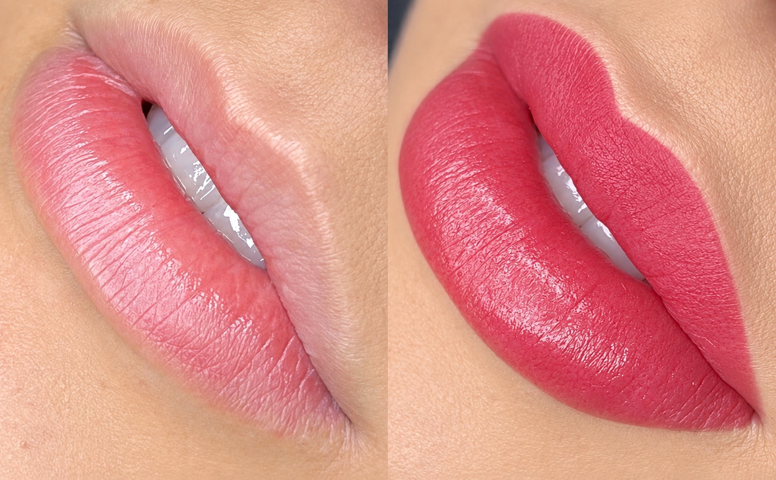 Comparación de labios antes y después de Blush Lips