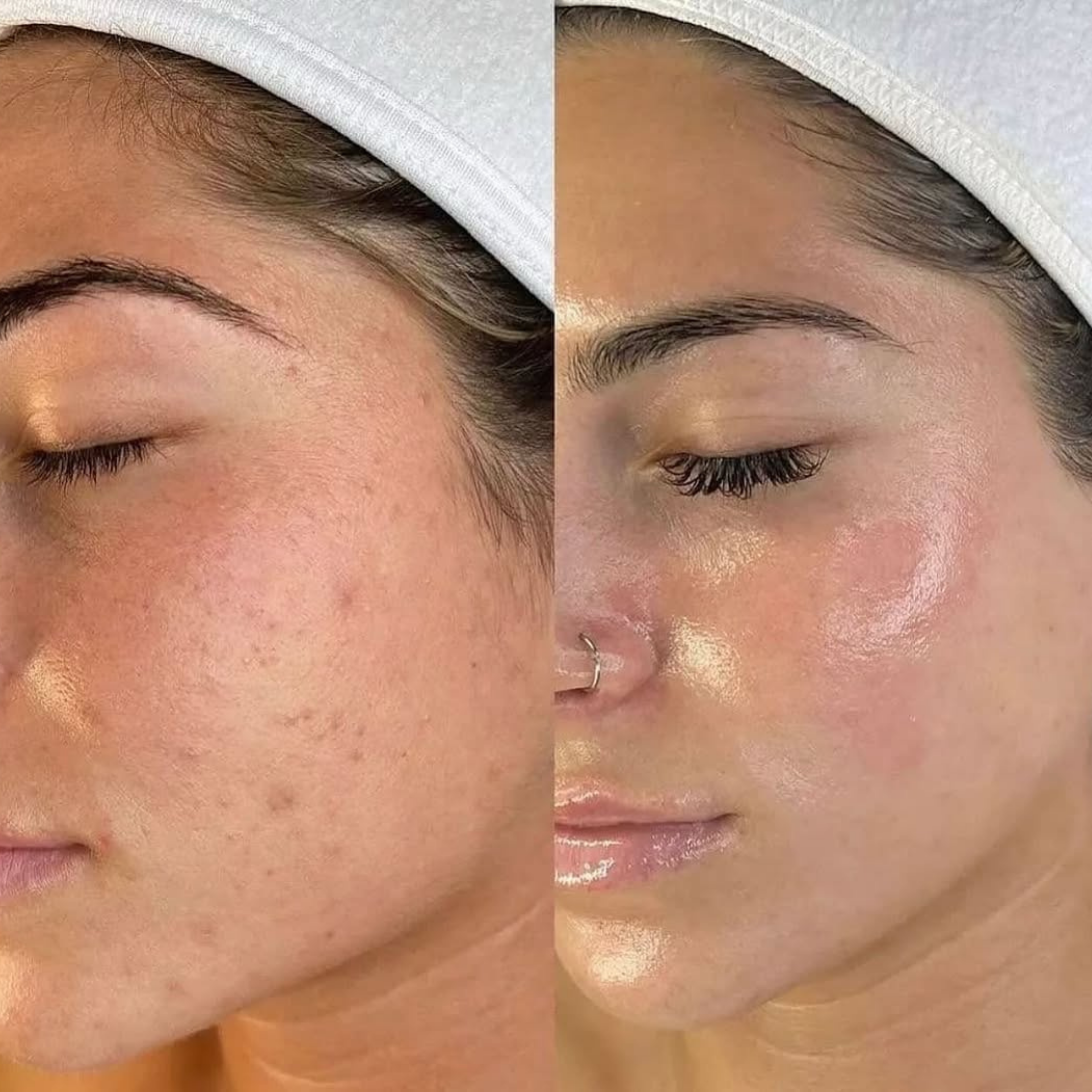 Before and after