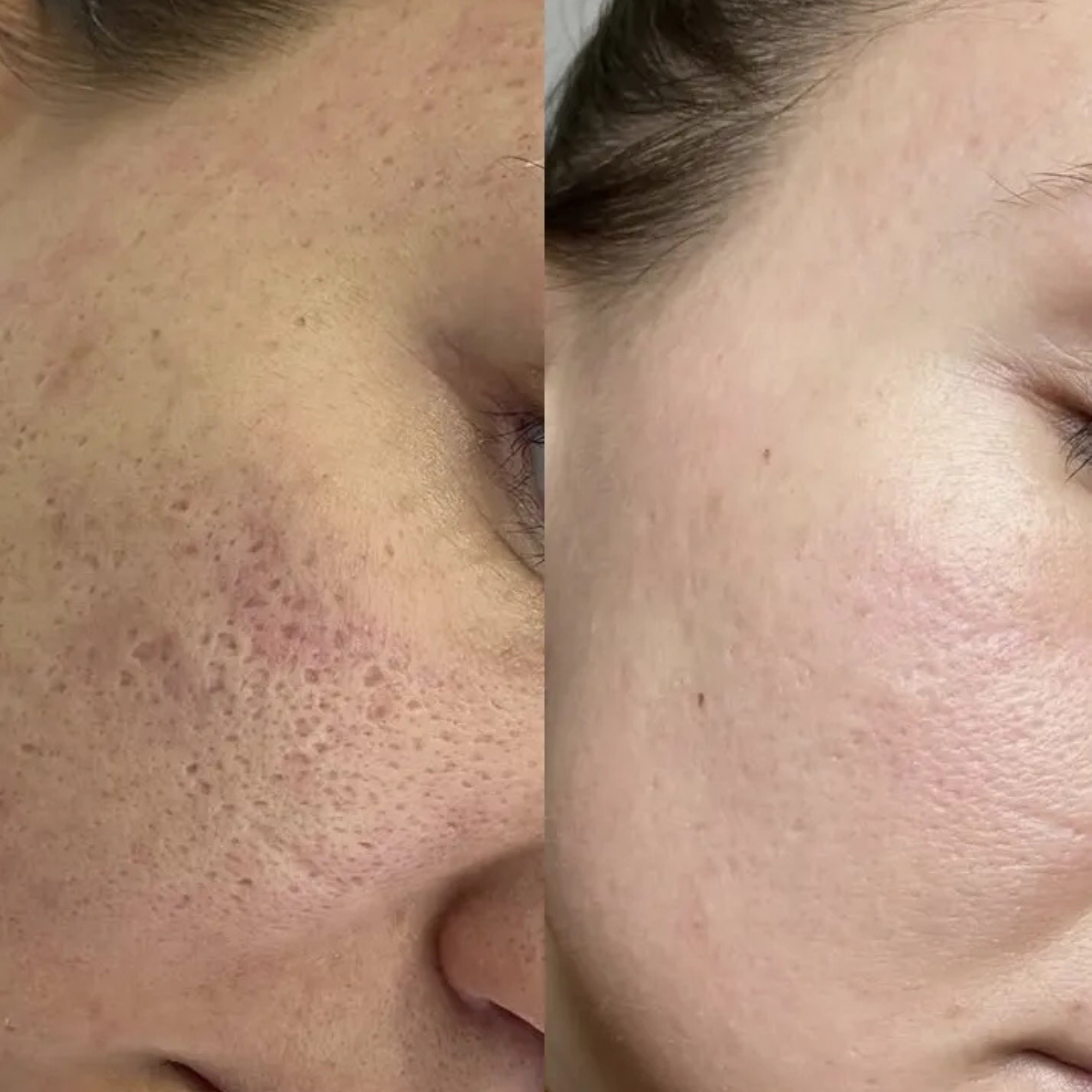 Before and after