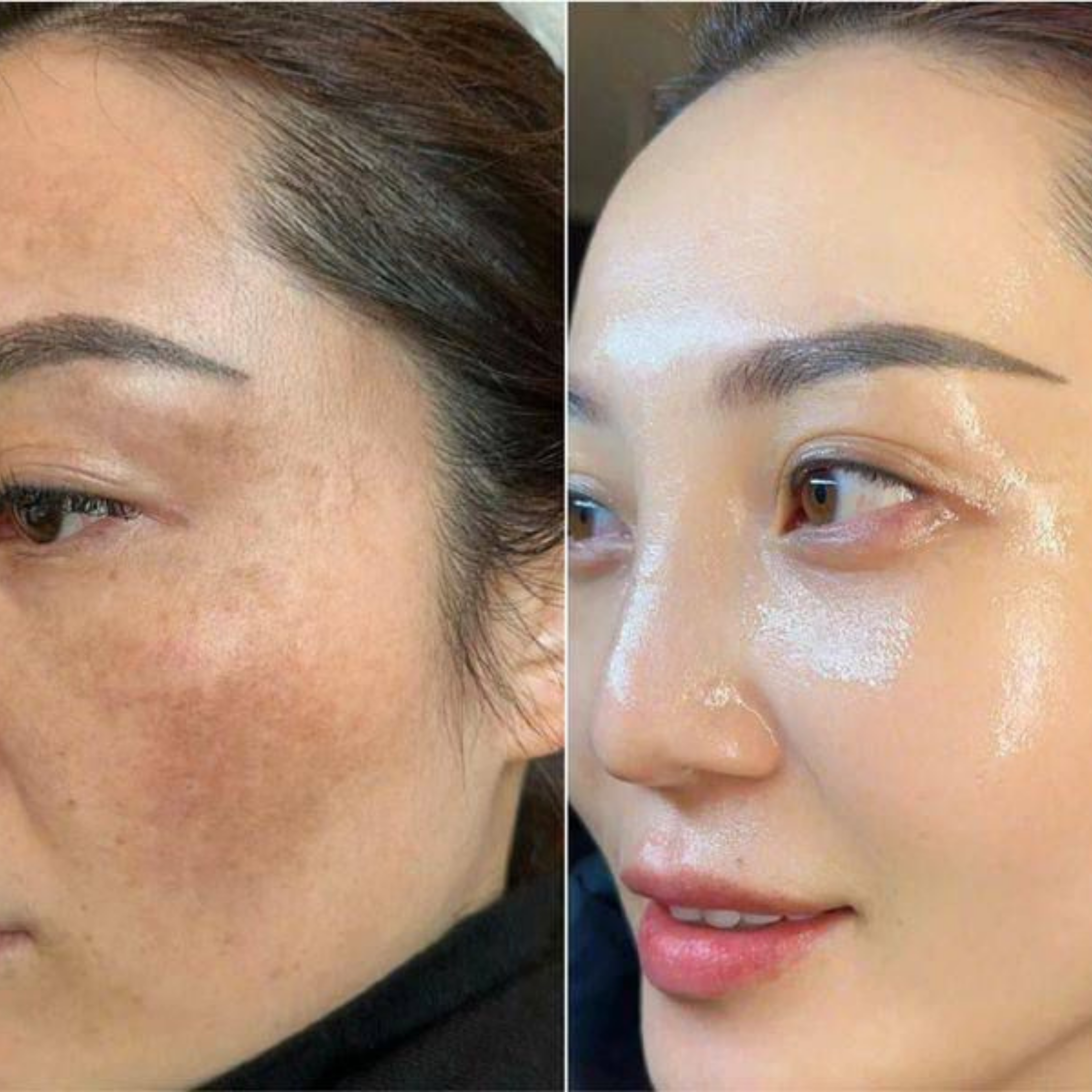 Before and after