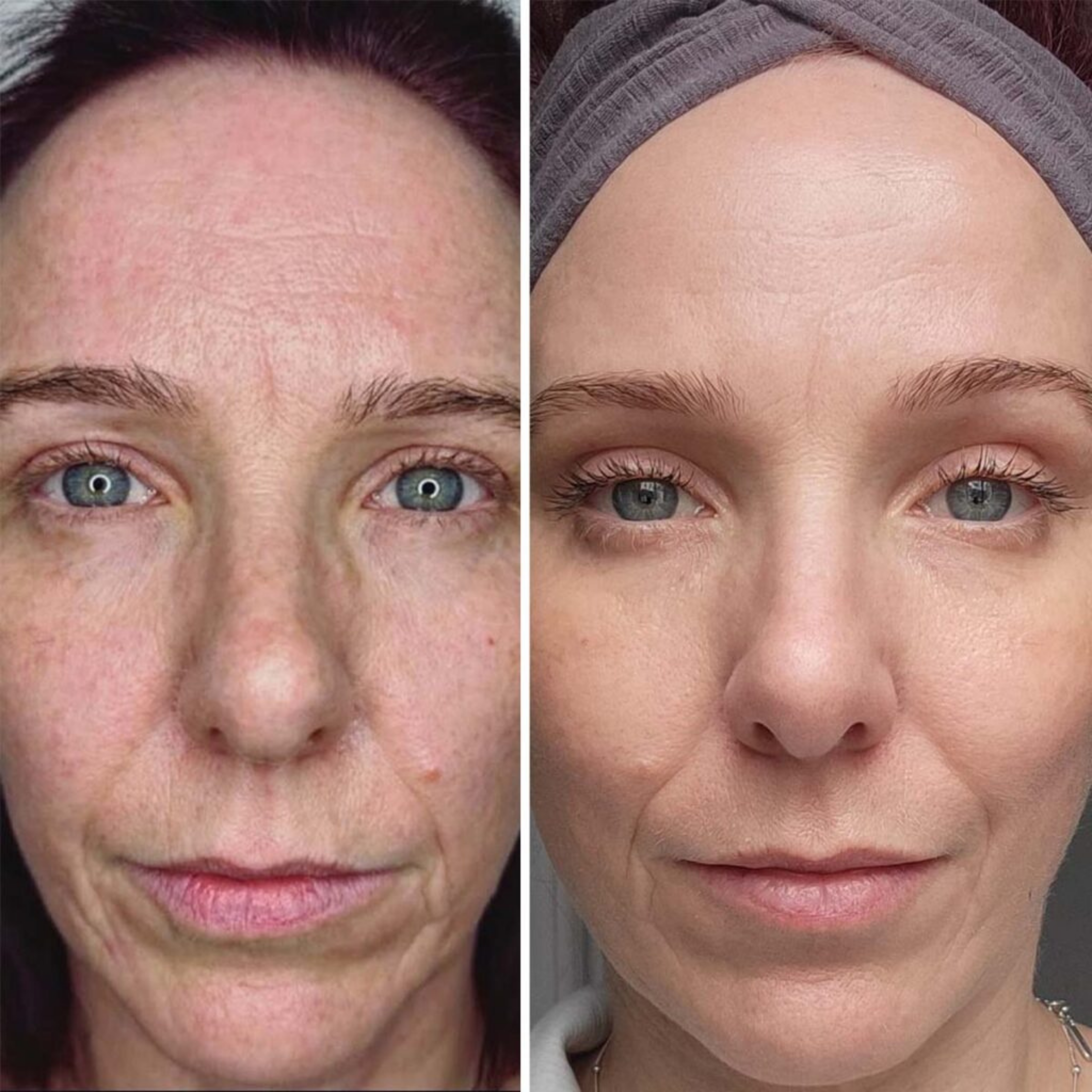 Before and after
