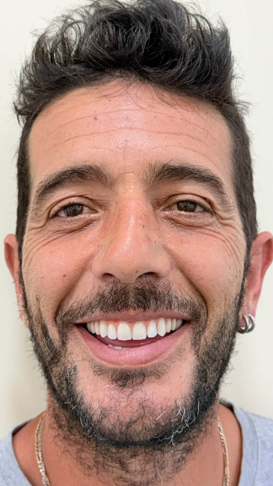 Depois - Caso 3