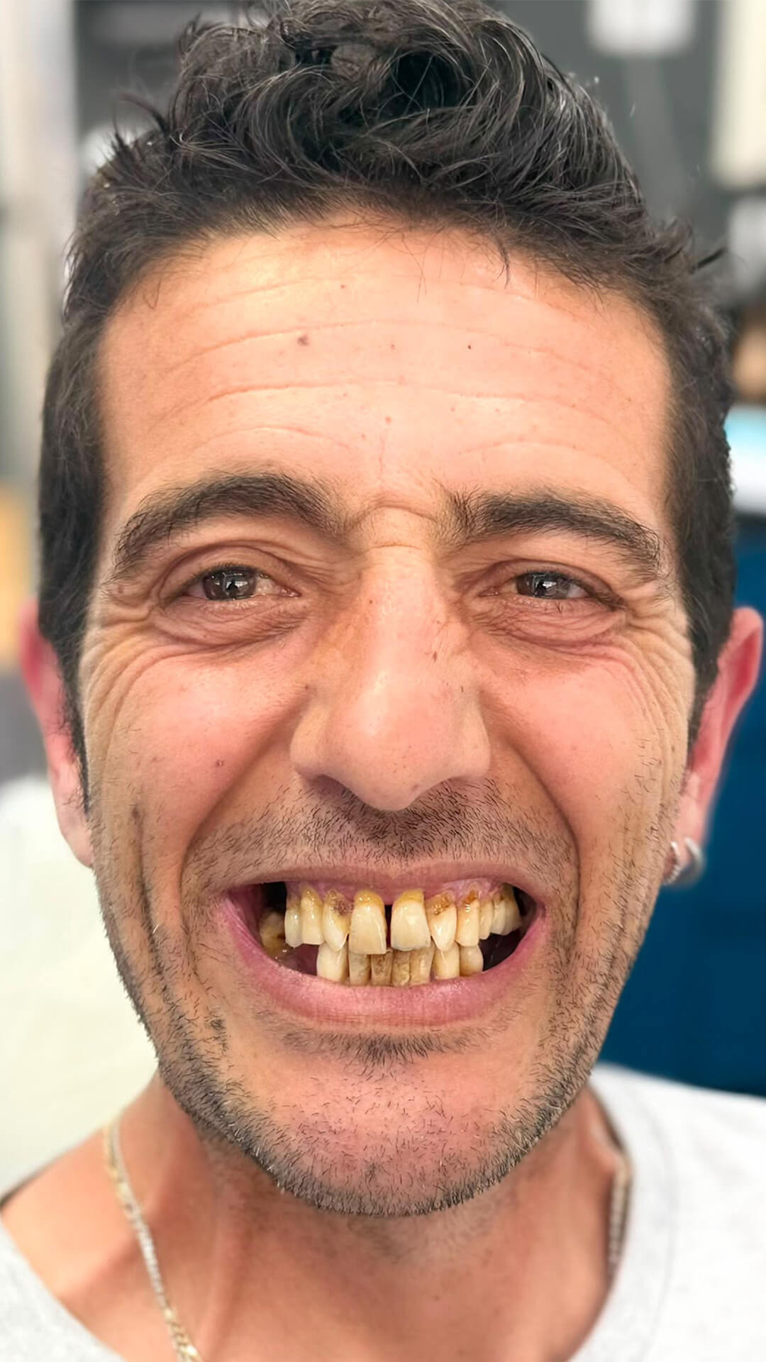 Antes - Caso 3