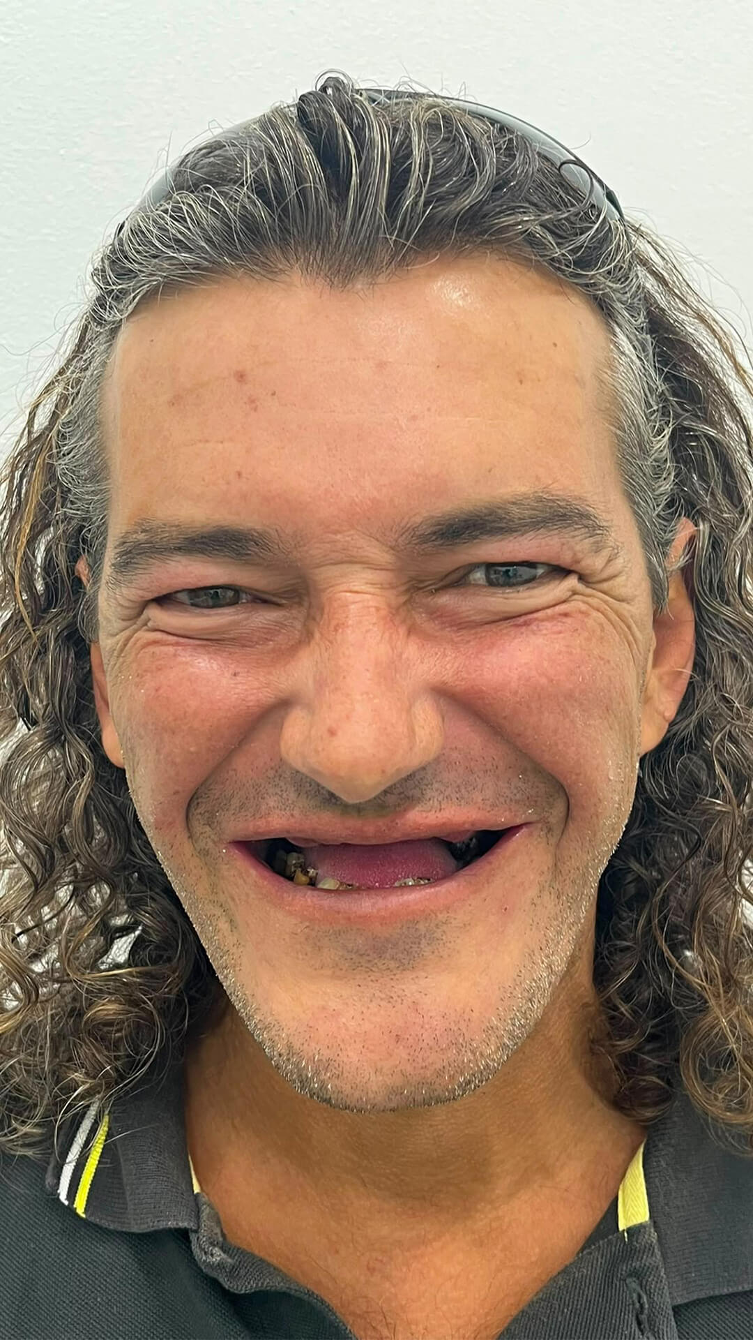 Antes - Caso 6