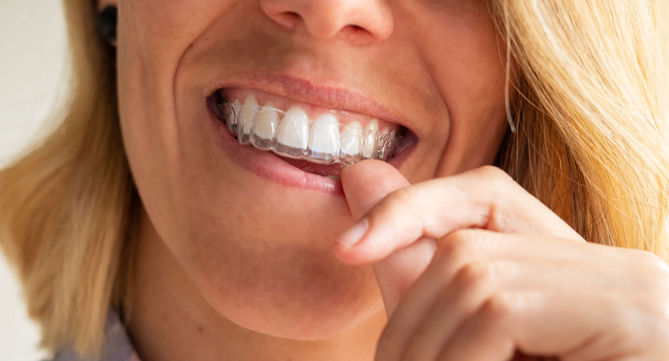 Woman holding invisalign
