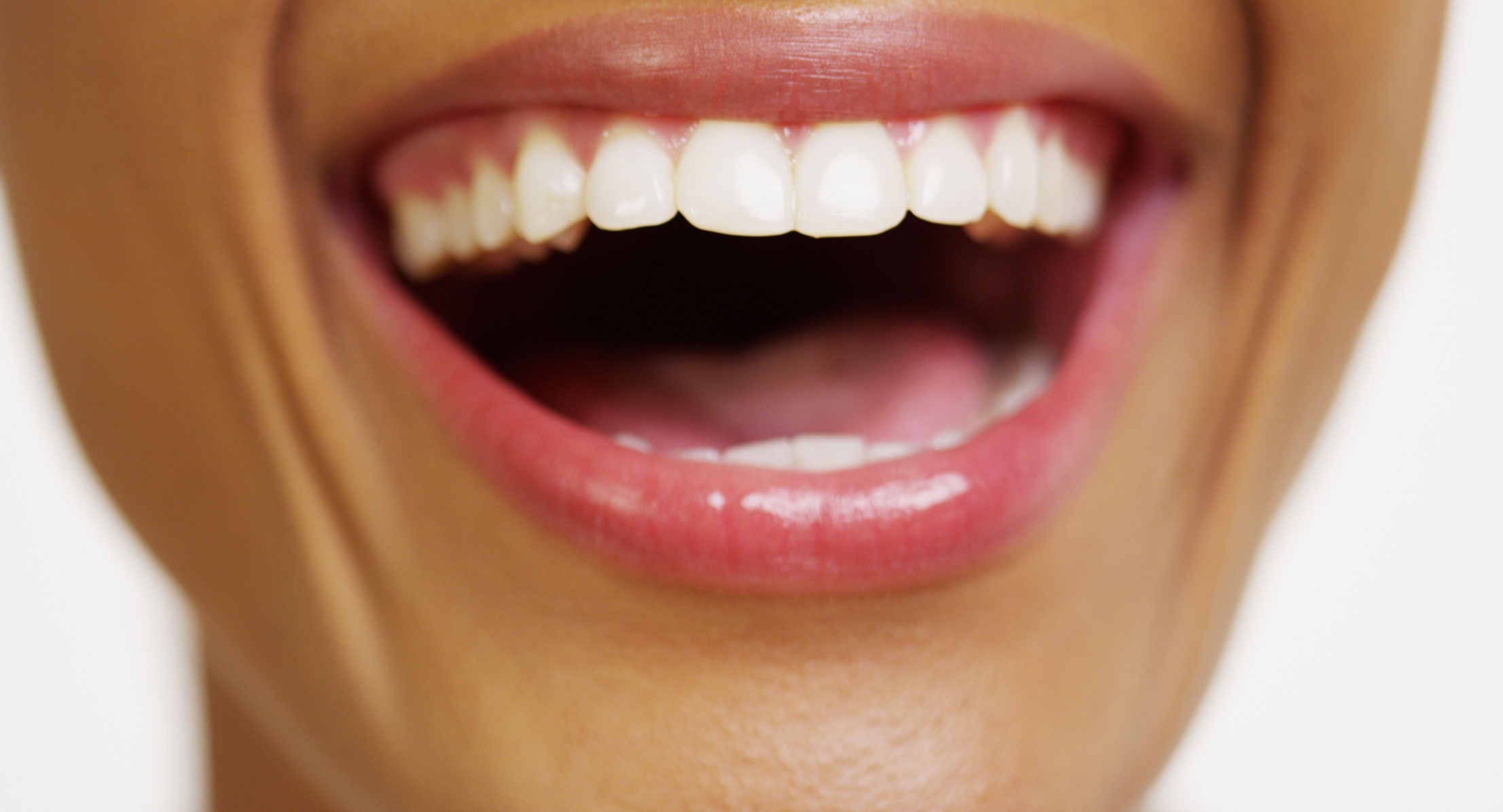 Woman with teeth whitening