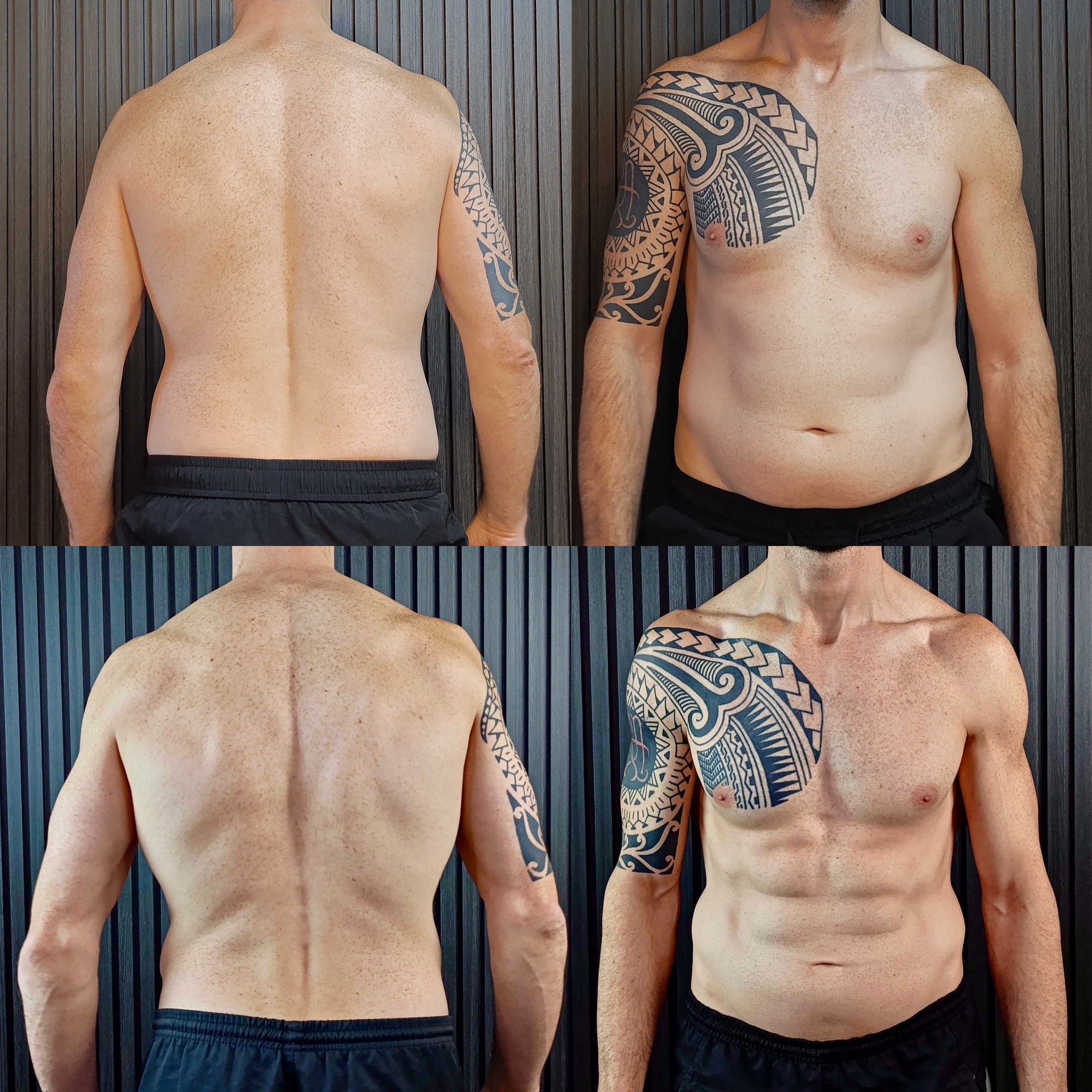 Antes y después — Juan, 46 años · Empresario capilar
