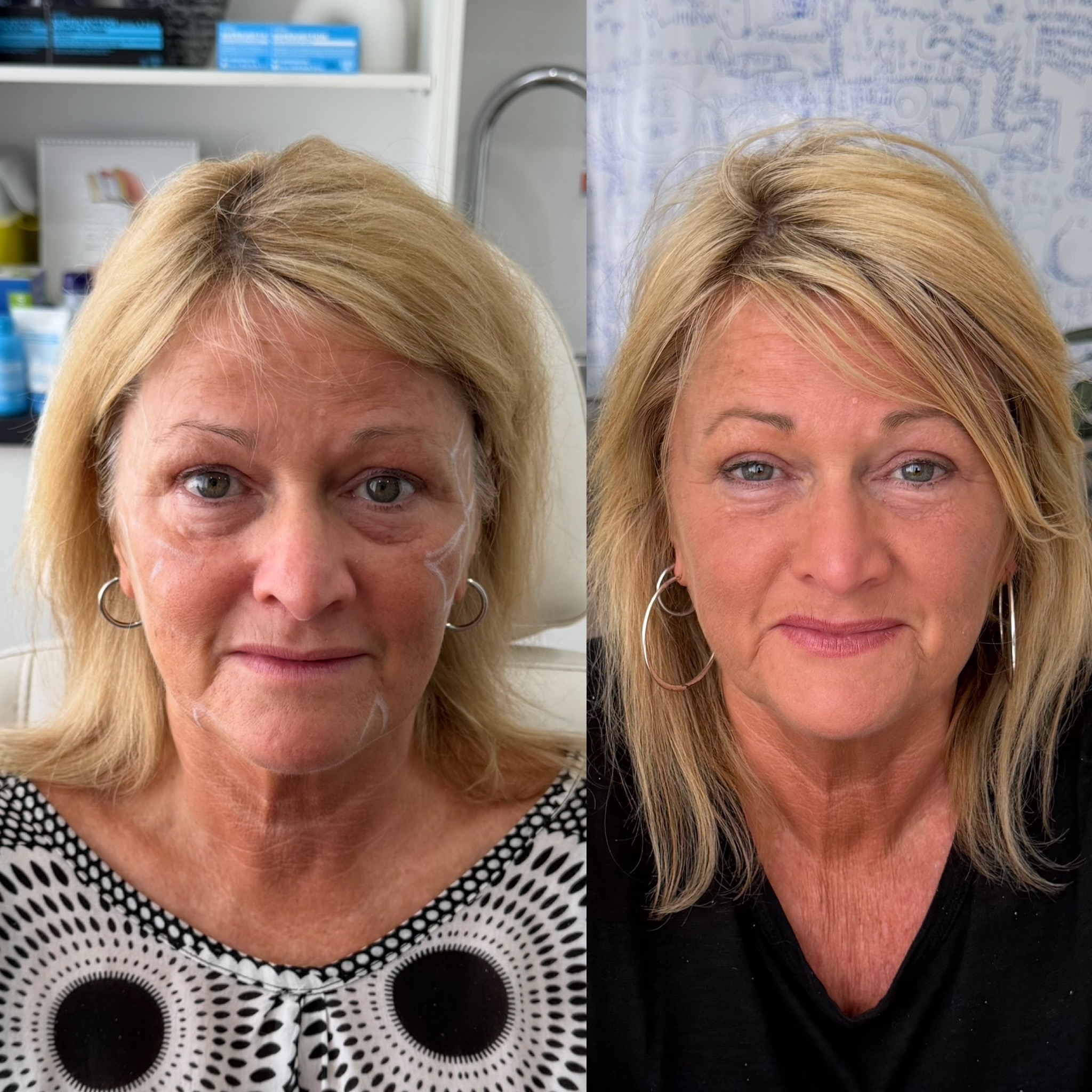 Before and after treatment result