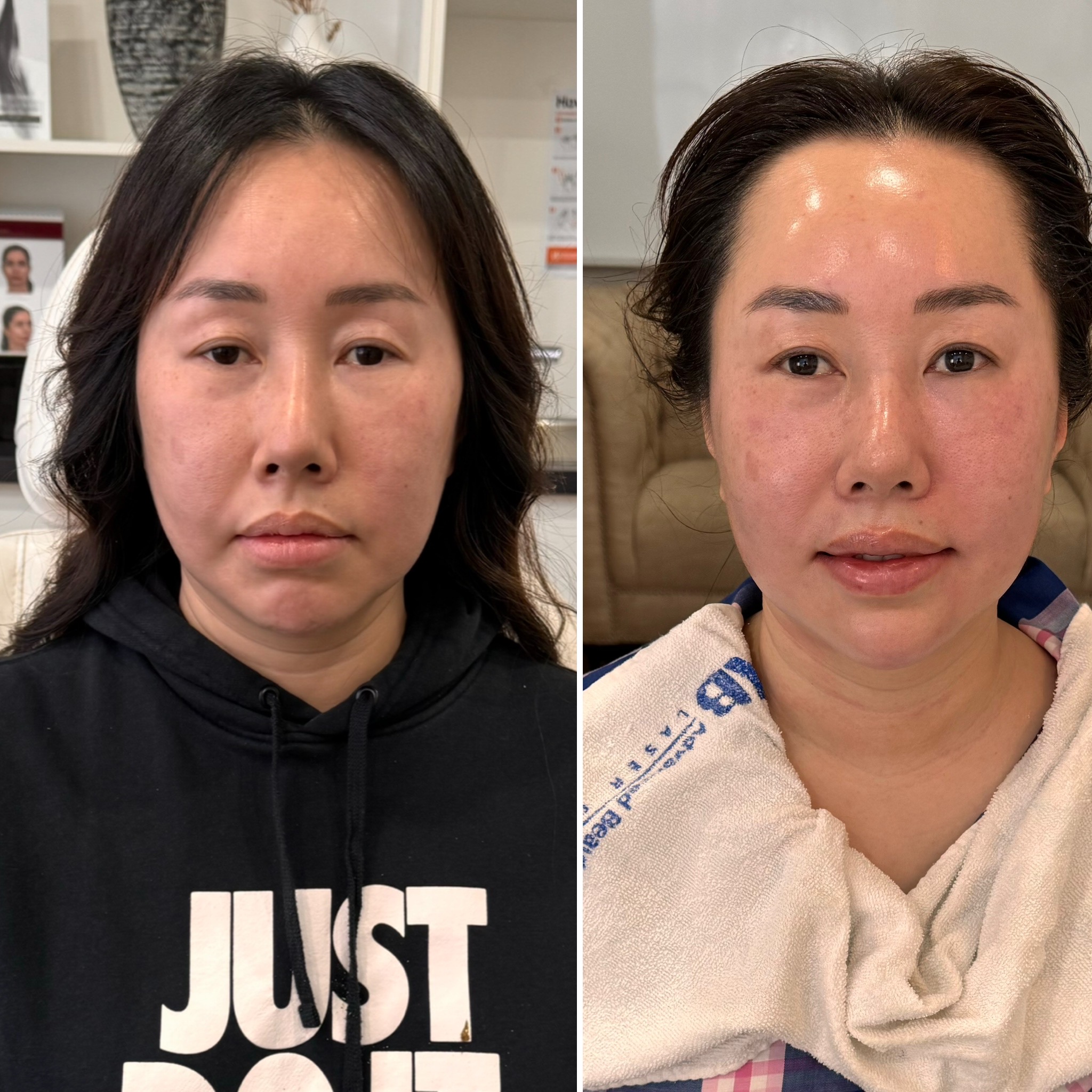 Before and after treatment result