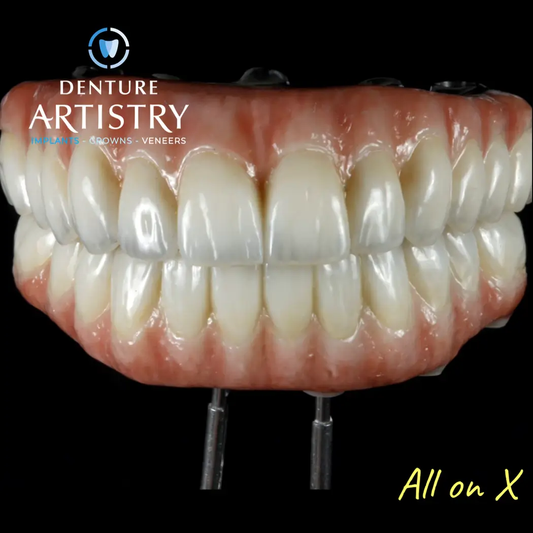 In-house digital dental lab