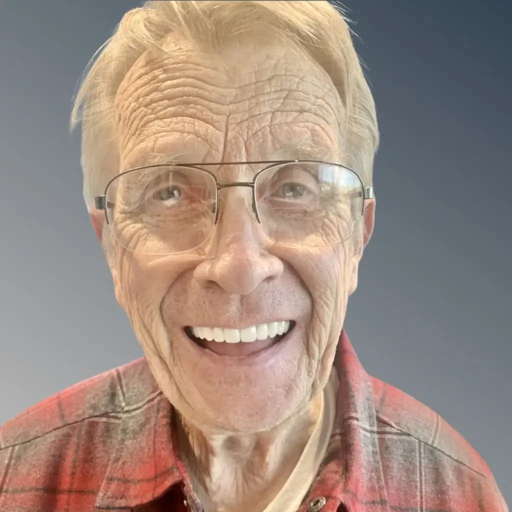 Patient smile transformation result 7