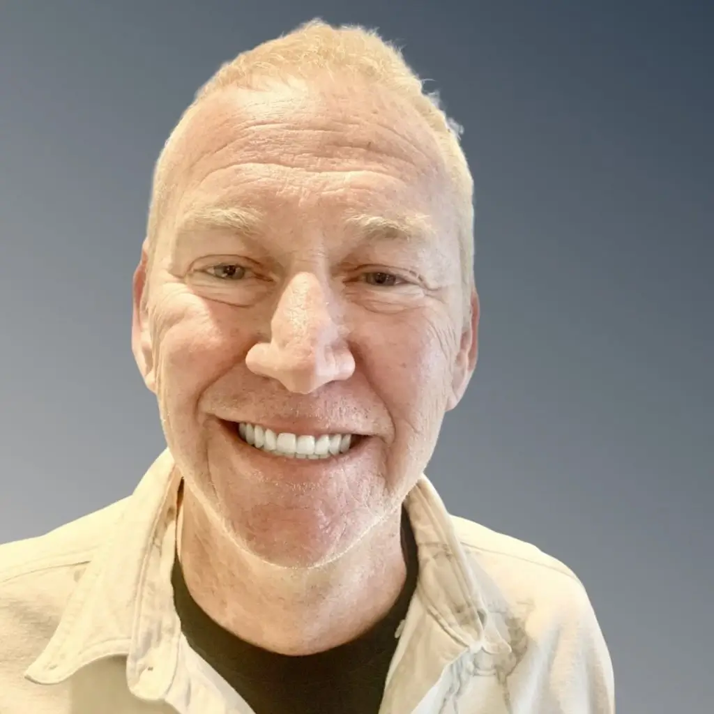 Patient smile transformation result 4