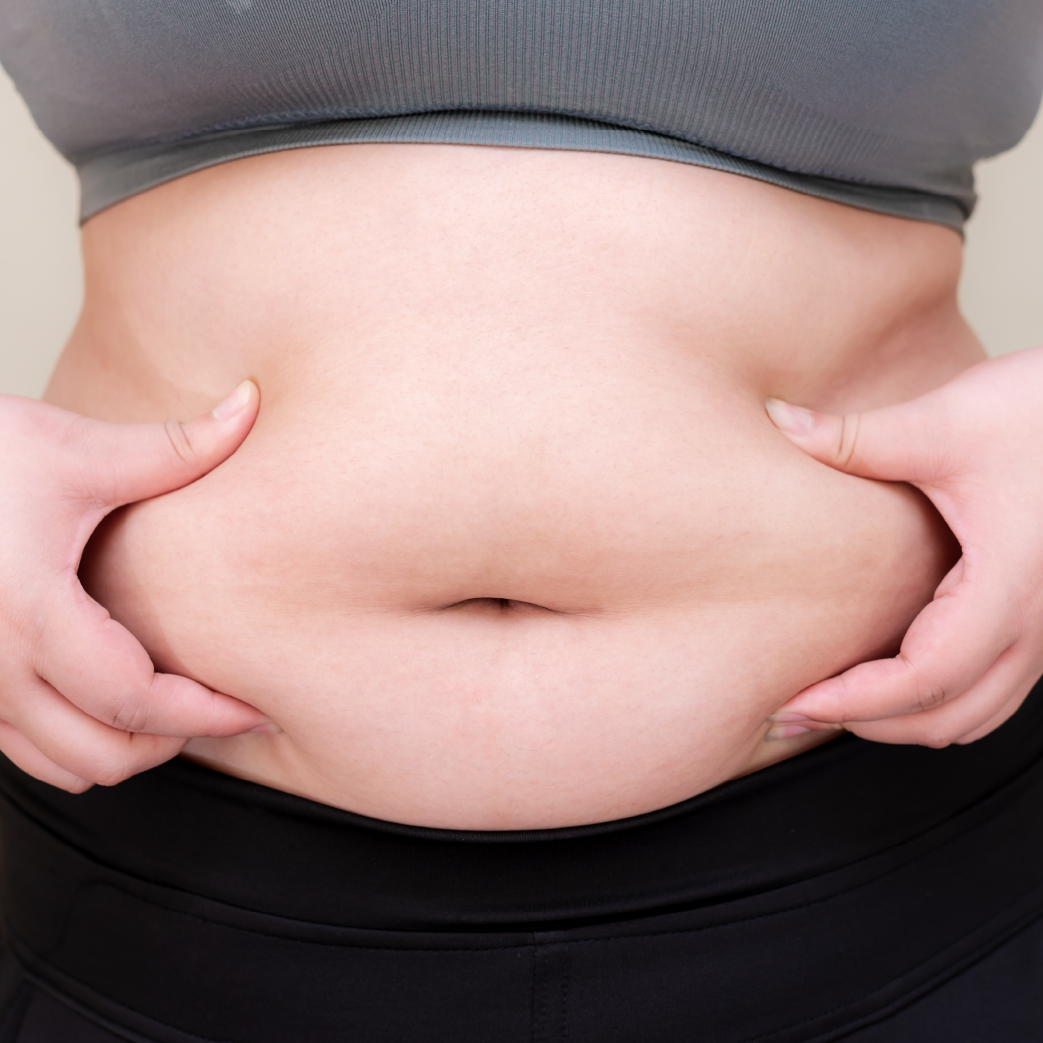 CoolTech Define fat-freezing treatment for love handles and belly fat