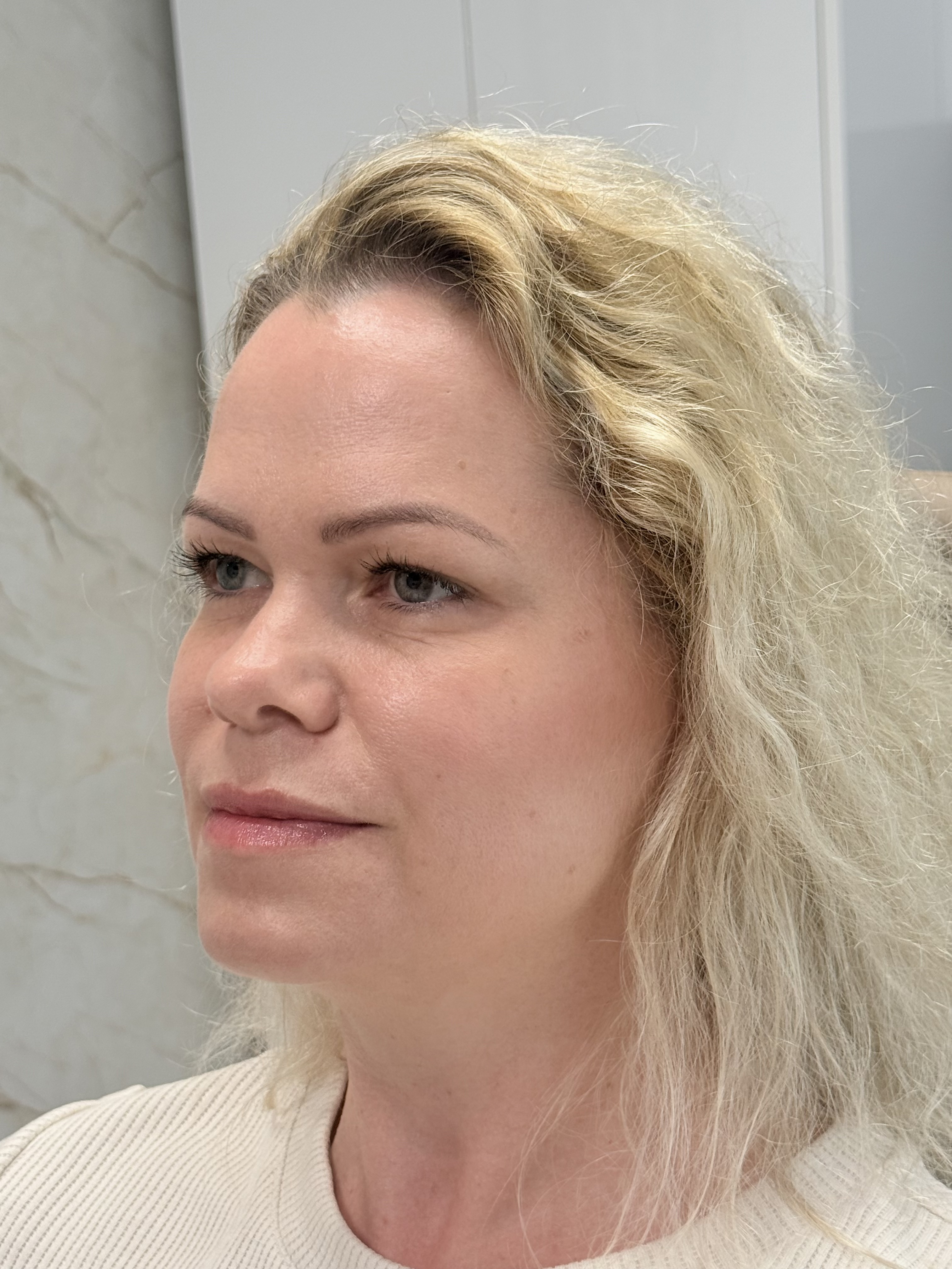Po ošetrení Signature Glow Protokol